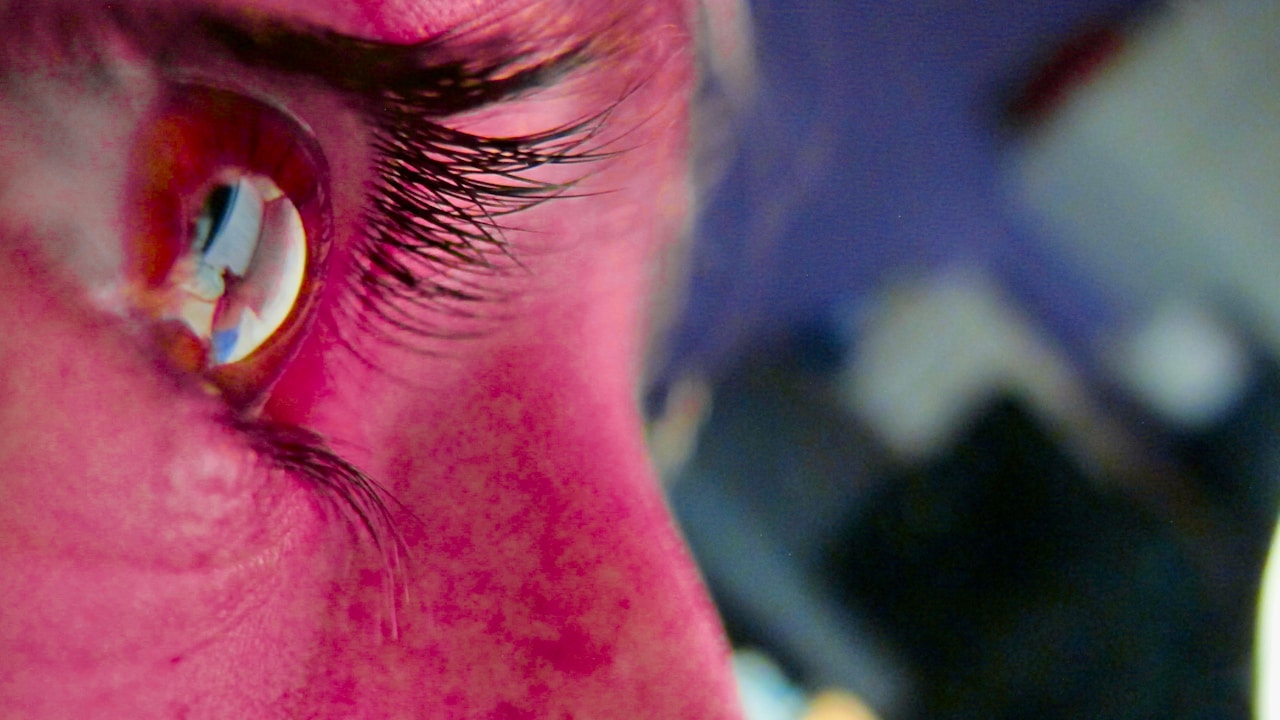 Understanding Pink Eye: Causes, Symptoms, and Treatment